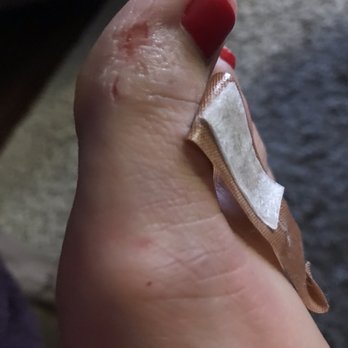 Envy Nails & Spa - This was done with a huge microplane colossal! In an area it should not have been used at. It also scrapped skin off from the bottom edge - Waxing Near Me - Manor, Texas