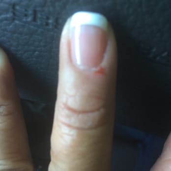 Golden Nails - Gelish nails...buffed nail resulted in cut...no antiseptic offered. - Nail Salons Near Me - Honolulu, Hawaii