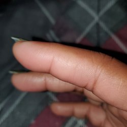 Angel Hair & Nail - Swollen index finger with throbbing pains up my hand and arm