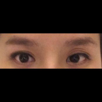 Aesthetic KS - With make ups on. Still very ugly. - Cosmetic Surgeons Near Me - Los Angeles, California Aesthetic KS - With make ups on. Still very ugly. - Cosmetic Surgeons Near Me - Los Angeles, California