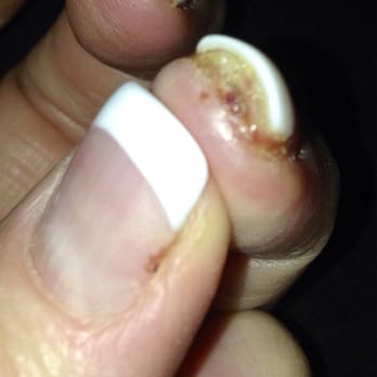 First Boutique Nails - I don't know how to tell if it's time to go to the doctor. - Nail Salons Near Me - Houston, Texas