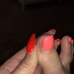 This is her toe. The nail took months to lift all the way and fall off from the infection. Gross