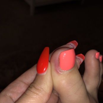 K&Q Nail Bar - This is her toe. The nail took months to lift all the way and fall off from the infection. Gross - Nail Salons Near Me - American Fork, Utah