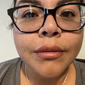 Kiss Me Vegas - About a week after first session 8/24 - Skin Care Near Me