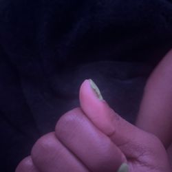 The lifted gel polish.