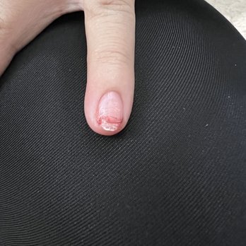Serenity Nail Spa - Nail bled because of the glue stuck on the skin. - Nail Salons Near Me - Pinole, California Serenity Nail Spa - Nail bled because of the glue stuck on the skin. - Nail Salons Near Me - Pinole, California