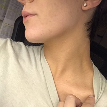 SUGARED + BRONZED - IM NOT WEARING MAKEUP. Face vs neck - Tanning Near Me - Hermosa Beach, California SUGARED + BRONZED - IM NOT WEARING MAKEUP. Face vs neck - Tanning Near Me - Hermosa Beach, California