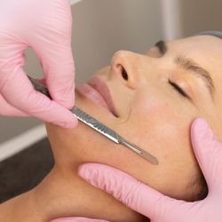 WECO Laser and Aesthetics Center - Columbia Laser and Aesthetics Center - Dermaplaning