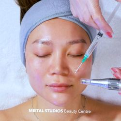 Meital Studios Beauty Centre - Micro-needling
