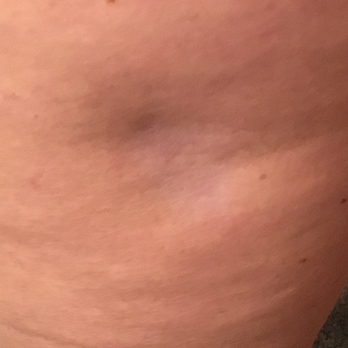 Stone Dermatology - Dermatologists Near Me - Sterling Heights, Michigan