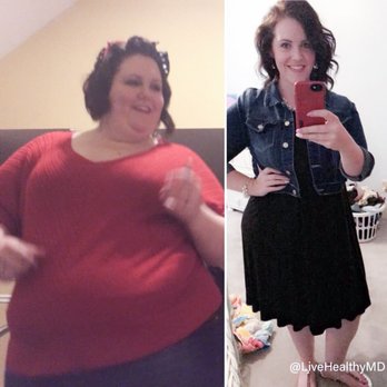 Live Healthy MD - Live Healthy MD, Bariatric Patient Success - Weight Loss Centers Near Me - Augusta, Georgia Live Healthy MD - Live Healthy MD, Bariatric Patient Success - Weight Loss Centers Near Me - Augusta, Georgia