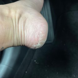 OC Nails - This is AFTER the pedi!!!!!