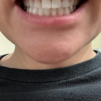 My Dentist Burbank - A great smile :) - General Dentistry Near Me - Burbank, California My Dentist Burbank - A great smile :) - General Dentistry Near Me - Burbank, California