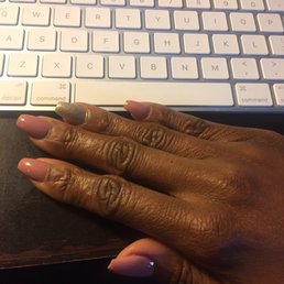 My nails after my initial visit