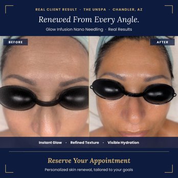 The UnSpa Skin Studio - Estheticians Near Me - Chandler , Arizona The UnSpa Skin Studio - Estheticians Near Me - Chandler , Arizona