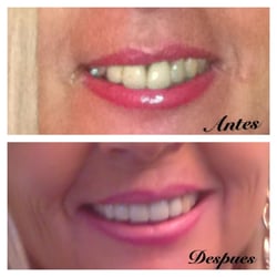 Shoker Devinder, DDS - Doctor Shoker's great work