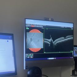 Stanton Optical - OTC scan that she scammed me into getting after saying well mom to mom if it was my kid I would be getting the scan?!?!