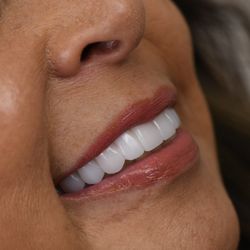 Revive Dental - A close up of a happy patient's smile at Revive Dental