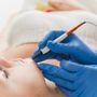 Photo of Illume Electrolysis