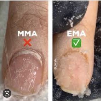 Center Nails & Spa - MMA IS NOT GOOD FOR THE NAIL - Nail Salons Near Me - Naples, Florida