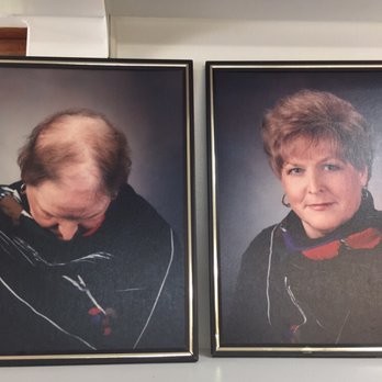 Complete Hair Replacement Center - Wigs Near Me - Saginaw, Michigan Complete Hair Replacement Center - Wigs Near Me - Saginaw, Michigan