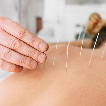 Acupuncture For All - Acupuncture Near Me - Columbia, Maryland