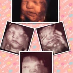 Womb Service 3D/4D Ultrasound Studio - 32 weeks and 3 days :)
