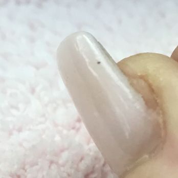 SB Nailbar - This pic shows how she filed the acrylic so that my natural nail was exposed! - Nail Salons Near Me - Santa Barbara, California
