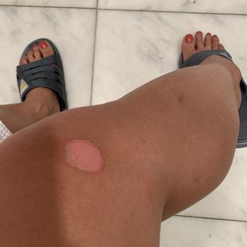 Heavenly Massage - BURNED IN THE STEAM ROOM. management scolded at me instead of apologizing . - Nail Salons Near Me - Chicago, Illinois Heavenly Massage - BURNED IN THE STEAM ROOM. management scolded at me instead of apologizing . - Nail Salons Near Me - Chicago, Illinois