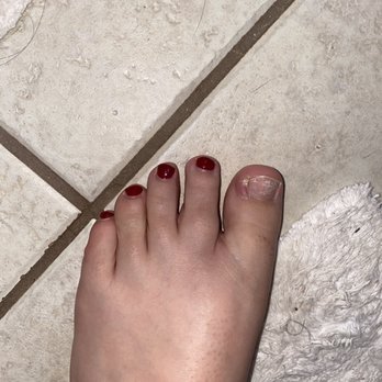 Amor Nails - Ingrown toenail - Nail Salons Near Me - Helotes, Texas