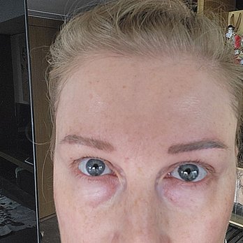 MK Brows - I mean look at this.... Two different colours, lengths, widths and densities. No microblading should look like this. - Permanent Makeup Near Me - Houston, Texas