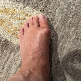 Foot Foot