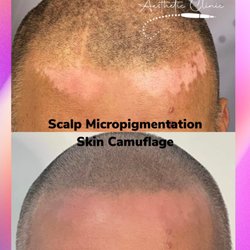 Scalp Empire Studio - Camouflage skin