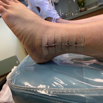 Austin Foot and Ankle Specialists - Podiatrists Near Me - Austin, Texas