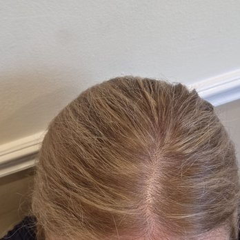 Rush Hair Studio - Top of the head after more bleaching by " toner" still patchy , overbleached strikes with lighter base - Hair Salons Near Me - Astoria, New York Rush Hair Studio - Top of the head after more bleaching by " toner" still patchy , overbleached strikes with lighter base - Hair Salons Near Me - Astoria, New York