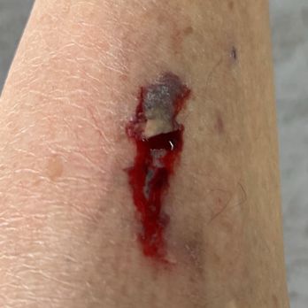 Extra Space Storage - Gash from rusty metal bar protruding from blind corner. 12-30-24. - Self Storage Near Me - Los Angeles, California Extra Space Storage - Gash from rusty metal bar protruding from blind corner. 12-30-24. - Self Storage Near Me - Los Angeles, California