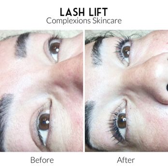 Complexions Skincare & Body - Skin Care Near Me - Salinas, California Complexions Skincare & Body - Skin Care Near Me - Salinas, California