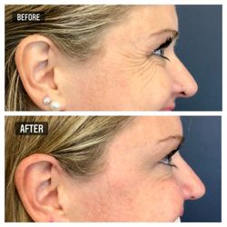 More before and after photos!