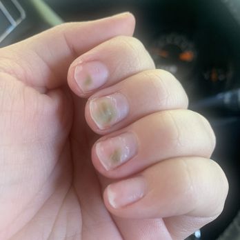 Bliss Nail Spa - After taking off acrylics, filing and cutting nails down. - Nail Salons Near Me - Columbia, Maryland