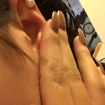 Black Lace Ink - 2 days after pierced it got lodged in my ear because it was too small and couldn't take the swelling - Piercing Near Me - Grayslake, Illinois