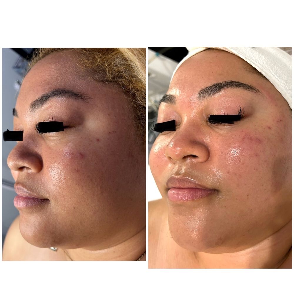 Hi Gorgeous Skin Care Logo