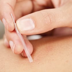 Better Health Acupuncture & Chinese Medicine