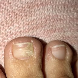 Thanks for the fungus Holly nails!