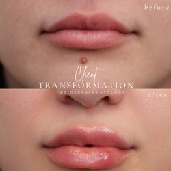 Ciocca Dermatology - Before & After
