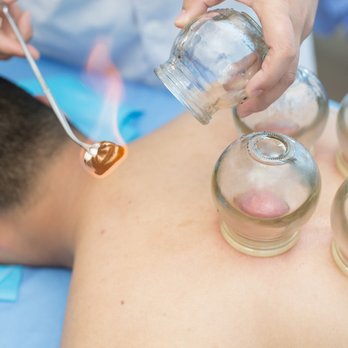 Graceful Services - Cupping - Massage Near Me - New York, New York