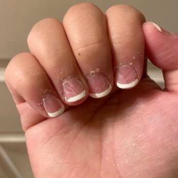 Nothing But Nails - My nails never look this bad - Nail Salons Near Me - Saratoga, California Nothing But Nails - My nails never look this bad - Nail Salons Near Me - Saratoga, California