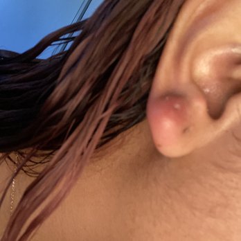 Body Kraze - right before i went to get it taken out - Piercing Near Me - Fontana, California Body Kraze - right before i went to get it taken out - Piercing Near Me - Fontana, California