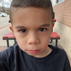 Highlands Elementary School - Does this out-door picture look like my son has bacterial or viral conjunctivitis?