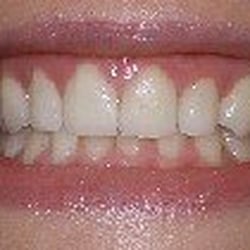 Laurence A Langer, DDS - After smile makeover