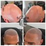Scalp Aesthetics Dearborn